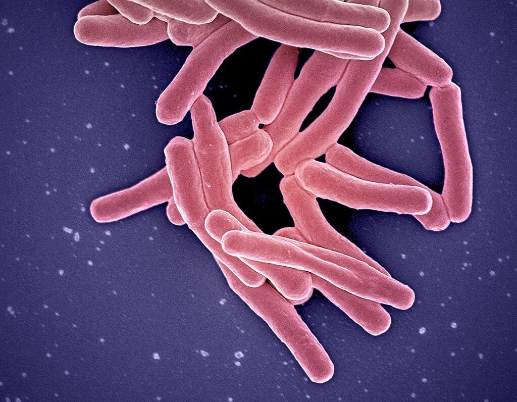 Tuberculosis, microscope image of batcturia